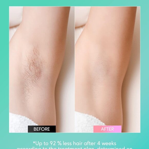 INNZA IPL Laser Hair Removal Device 10 Energy Levels X003UJBMOH - Picture 4 of 7
